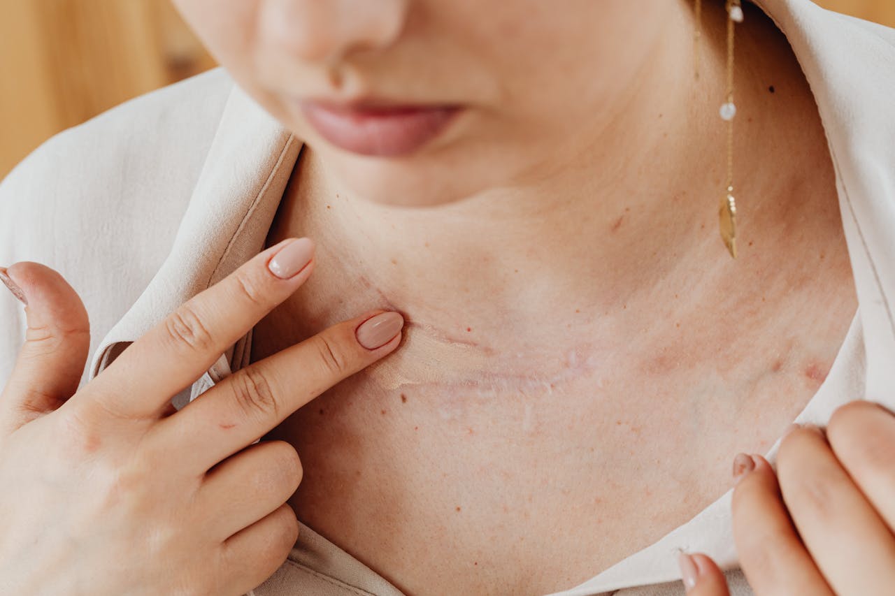 Top Post-Surgery Scar Care Questions Answered: Expert Tips for Healing & Scar Management